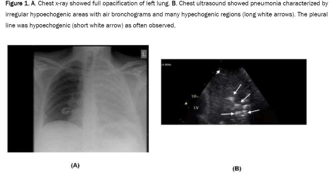 medical-case-opacification