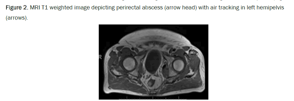 medical-case-perirectal