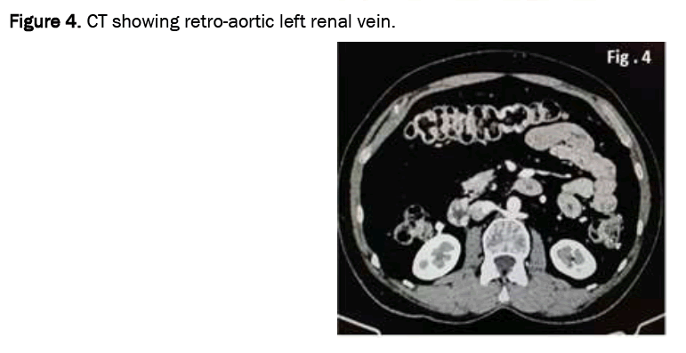 medical-case-renal