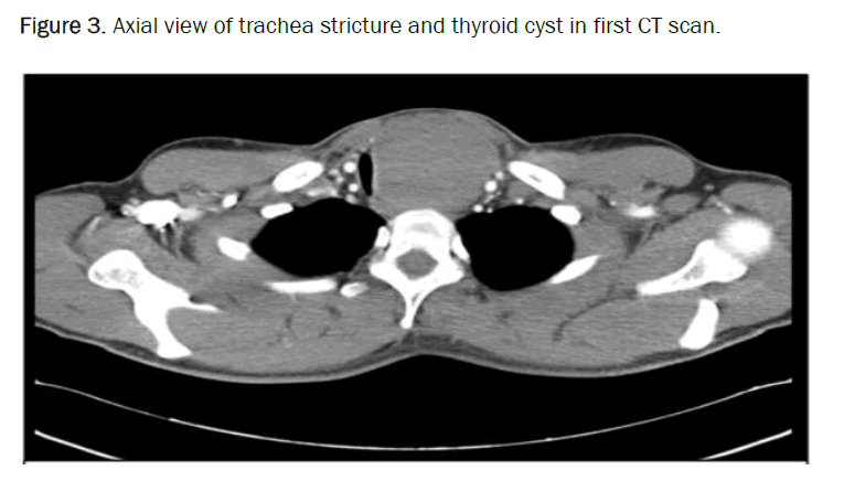 medical-case-thyroid