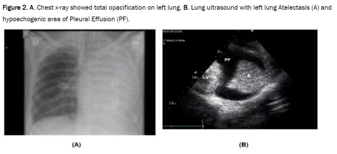 medical-case-ultrasound