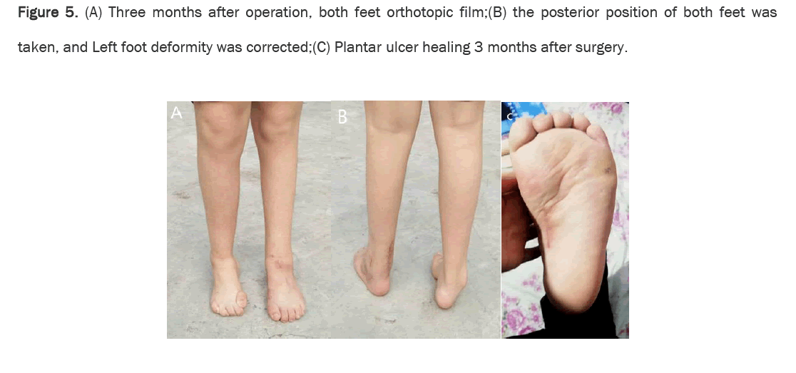 medical-health-orthotopic