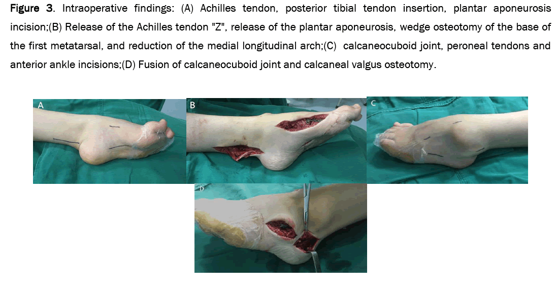 medical-health-tendon