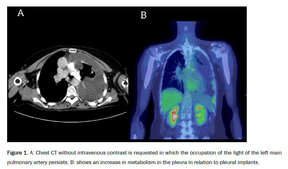 respiratory-intravenous