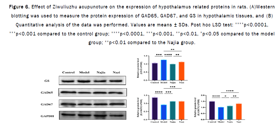 JPPS-Effect