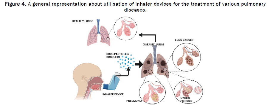 JPPS-inhaler