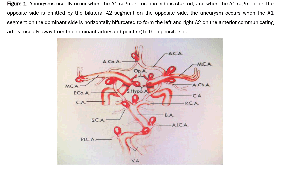 biology-demonstrated-aneurysms