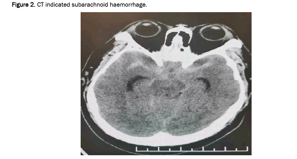 biology-demonstrated-subarachnoid