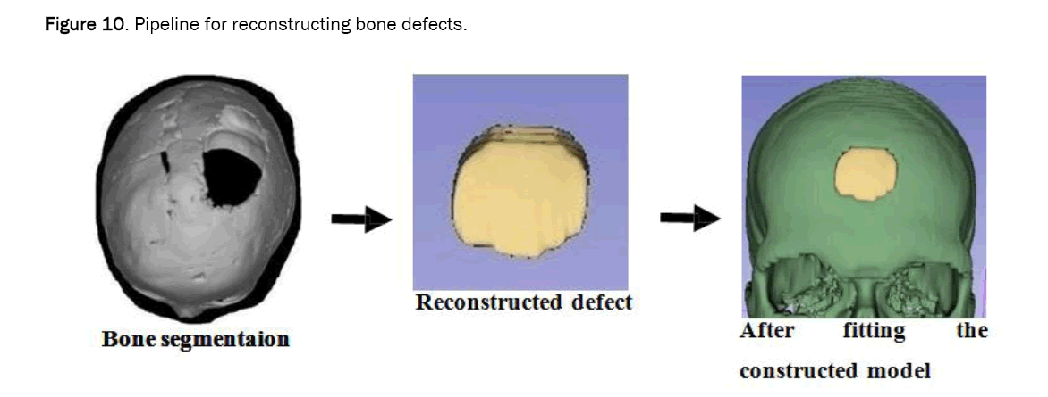 material-sciences-bone