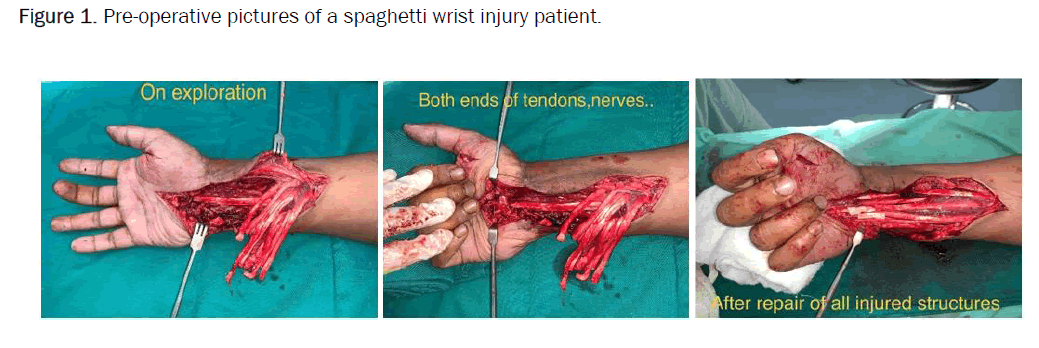 medical-health-spaghetti