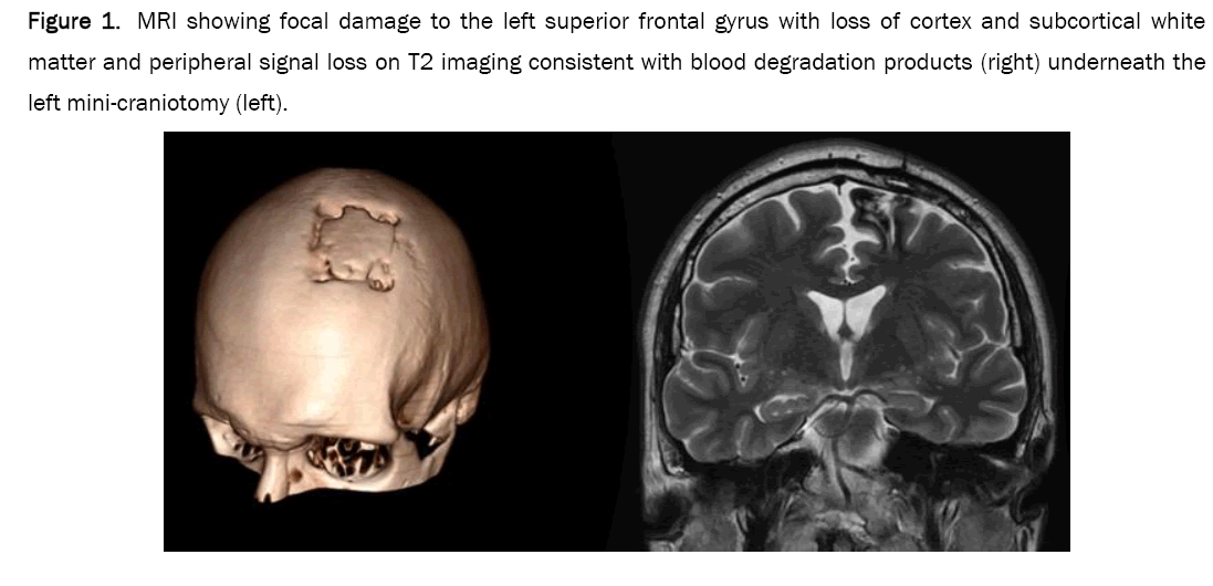 pharmacy-pharmaceutical-damage