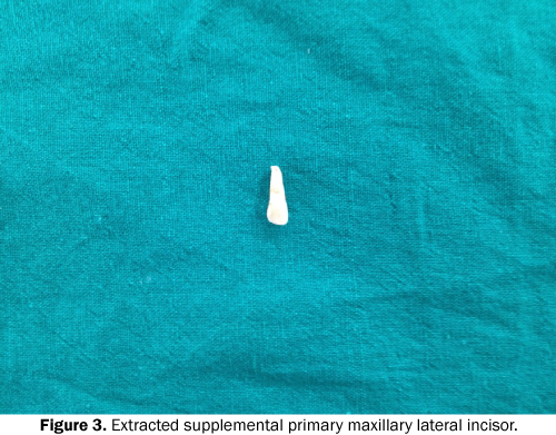 Dental-Sciences-Extracted-supplemental