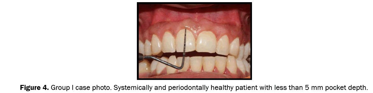Dental-Sciences-Group-I-case-photo-Systemically-and-periodontally