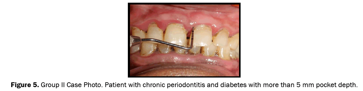 Dental-Sciences-Group-II-case-photo-Systemically-and-periodontally