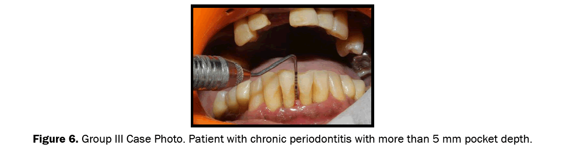 Dental-Sciences-Group-III-case-photo-Systemically-and-periodontally