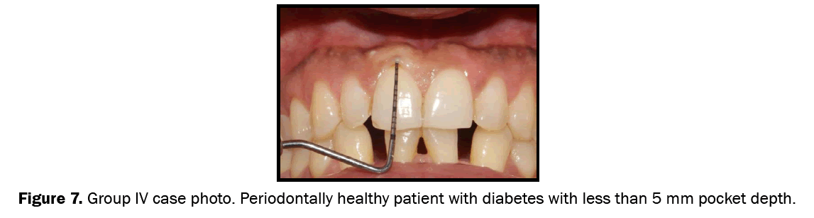 Dental-Sciences-Group-IV-case-photo-Systemically-and-periodontally