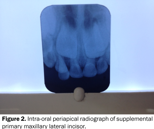 Dental-Sciences-Intra-oral