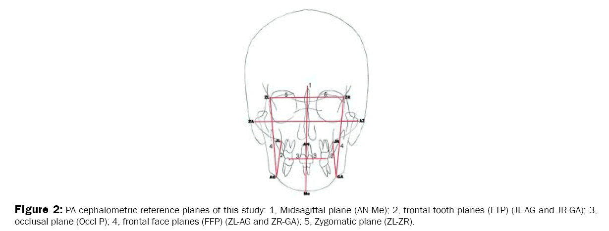 Dental-Sciences-PA-cephalometric-landmarks-used-study