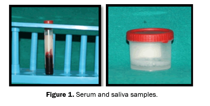 Dental-Sciences-Serum-and-saliva-samples