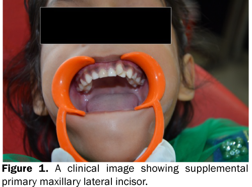 Dental-Sciences-clinical-image