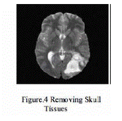 Figure 4a