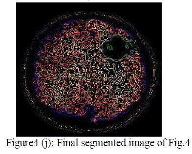 Figure 4j