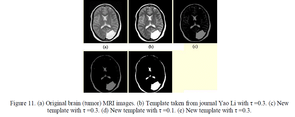 Figure 11