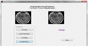 Figure 4d