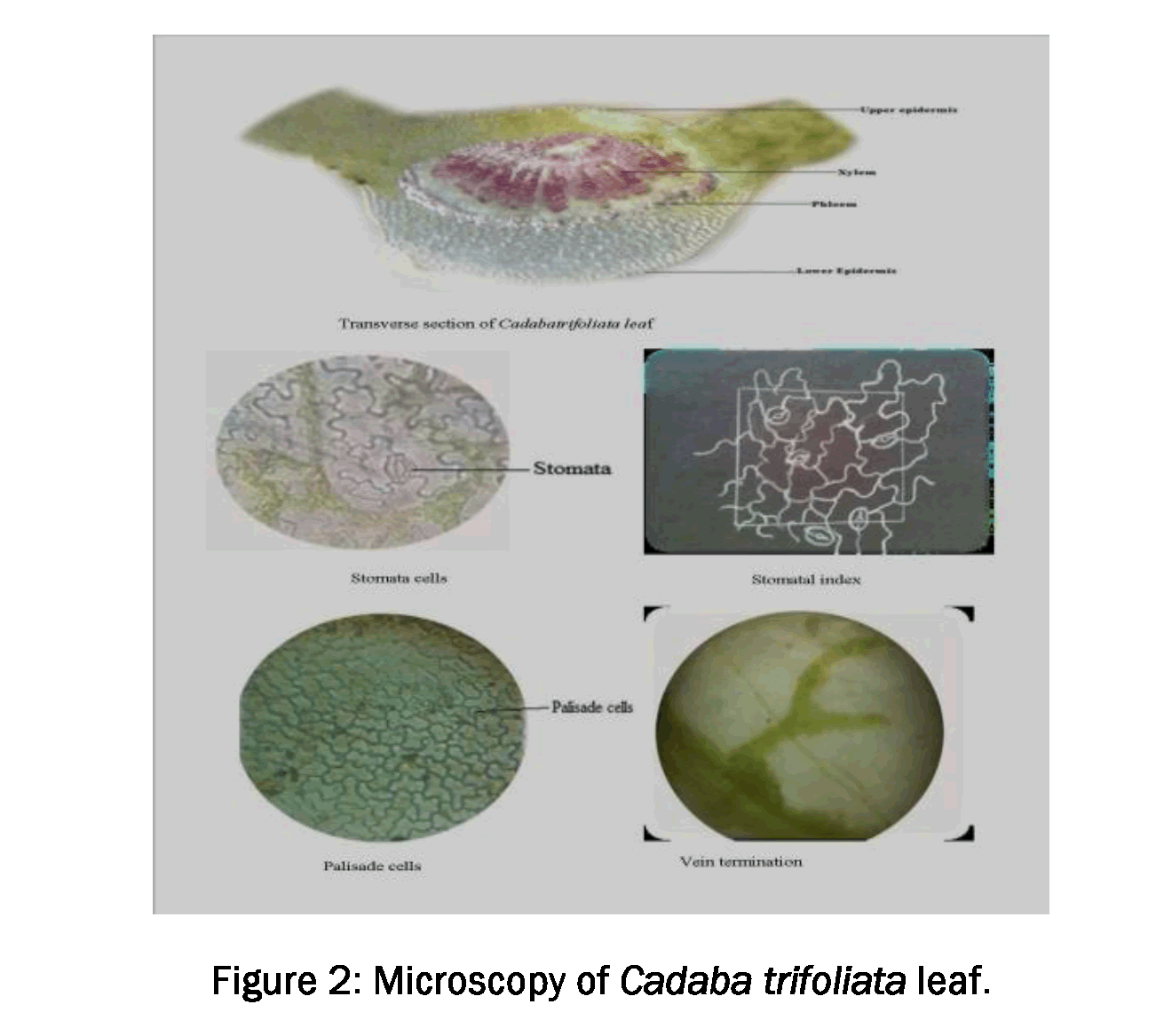Pharmacognsoy-Phytochemistry-Microscopy-Cadaba-trifoliata-leaf