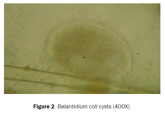 biology-cysts