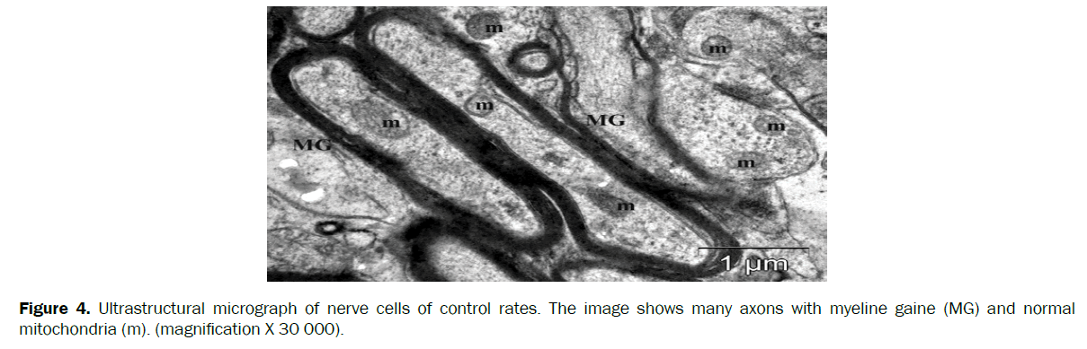 biology-nerve-cells-myeline-gaine