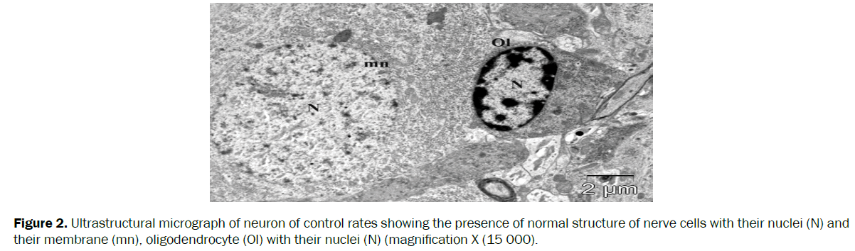 biology-ultrastructural-micrograph-neuron