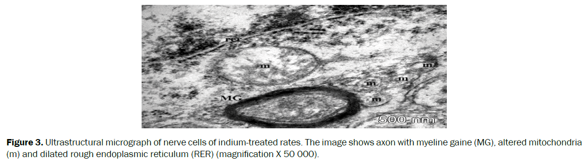 biology-ultrastructural-micrograph-neuron