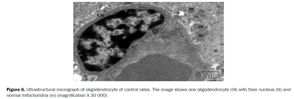 biology-ultrastructural-micrograph-oligodendrocyte