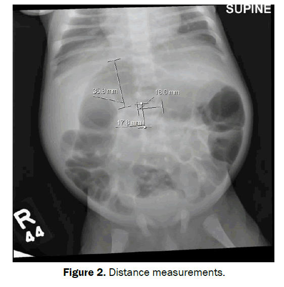 clinical-medical-Distance-measurements