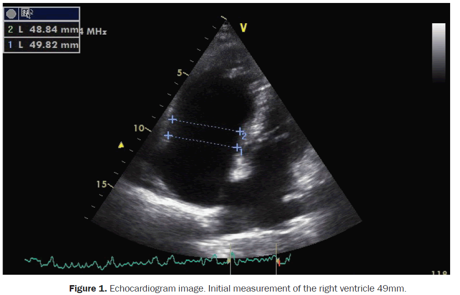 clinical-medical-Echocardiogram-image