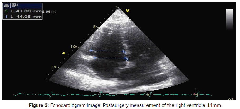 clinical-medical-Postsurgery-measurement