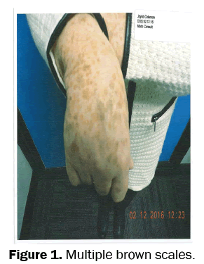 clinical-medical-case-brown-scales