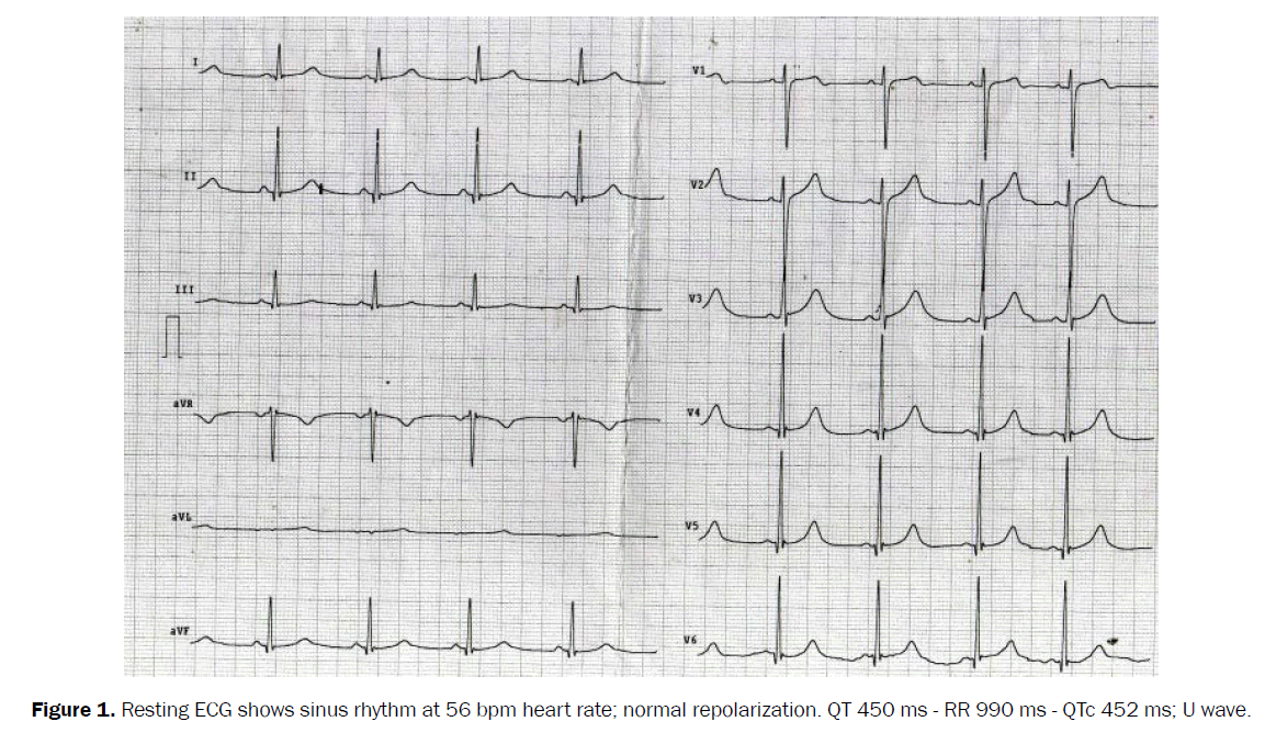 ejbio-heart-rate