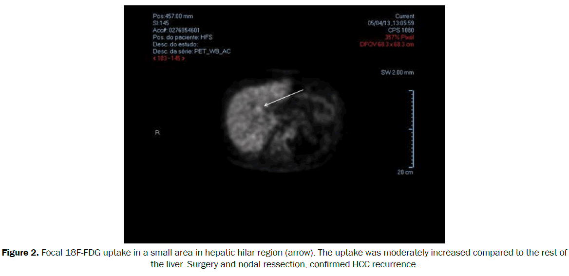 clinical-medical-hepatic-hilar