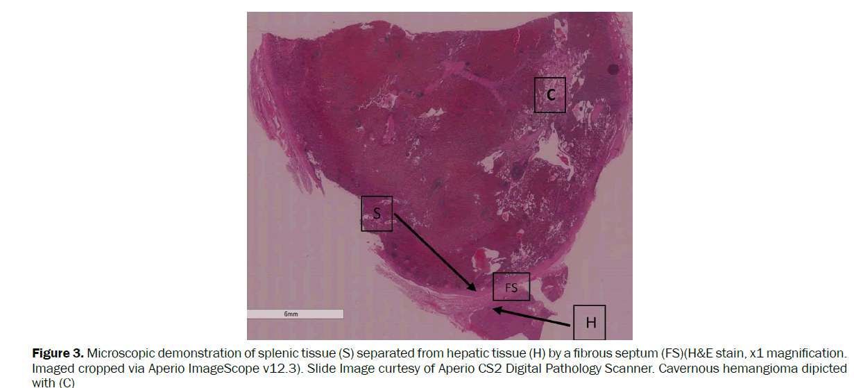 clinical-medical-hepatic-tissue