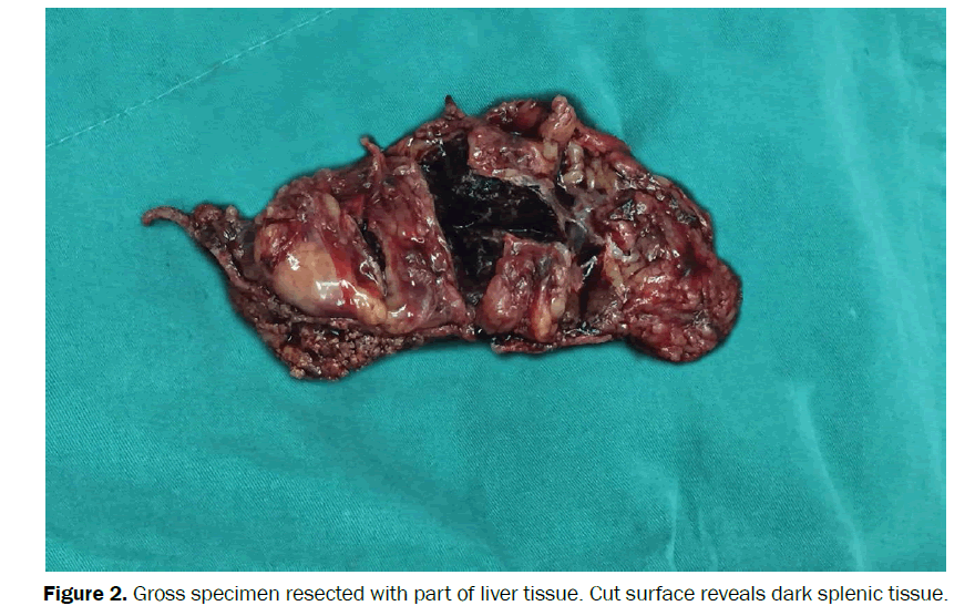 clinical-medical-liver-tissue