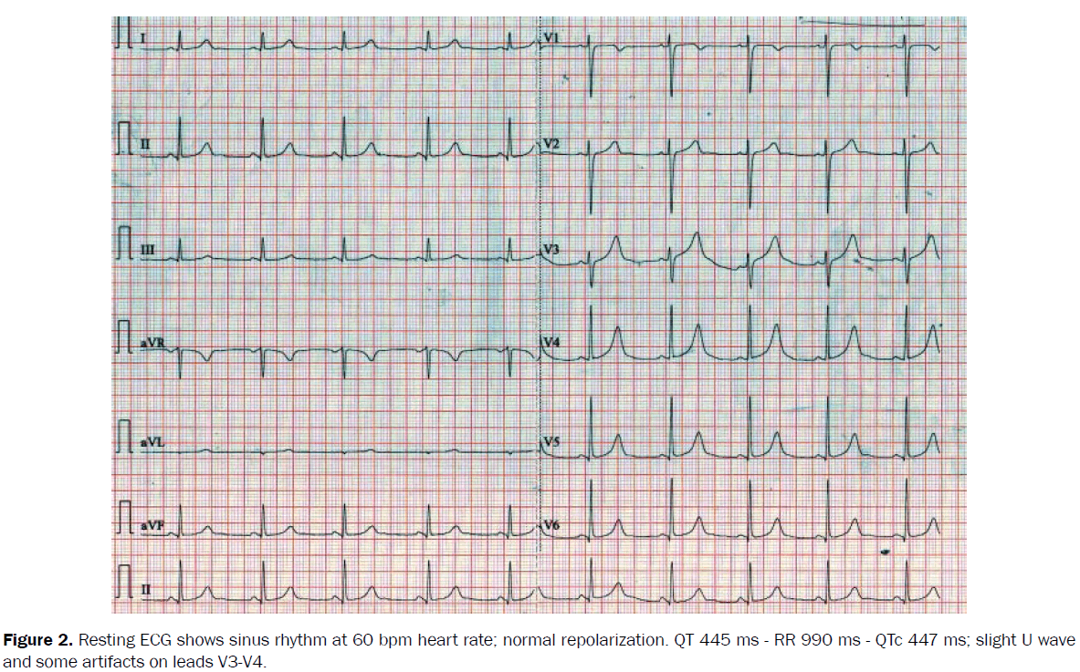 ejbio-normal-repolarization