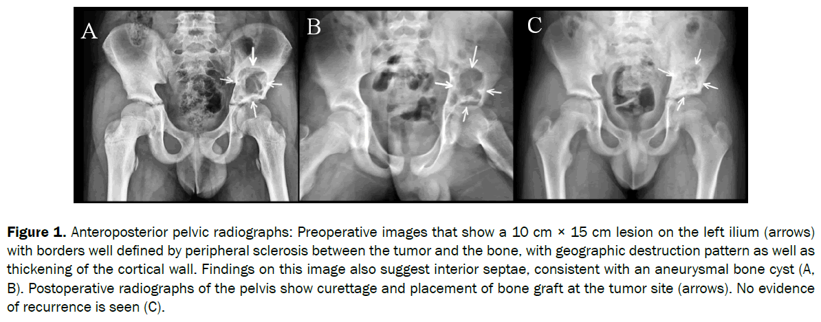 clinical-medical-pelvic-radiographs