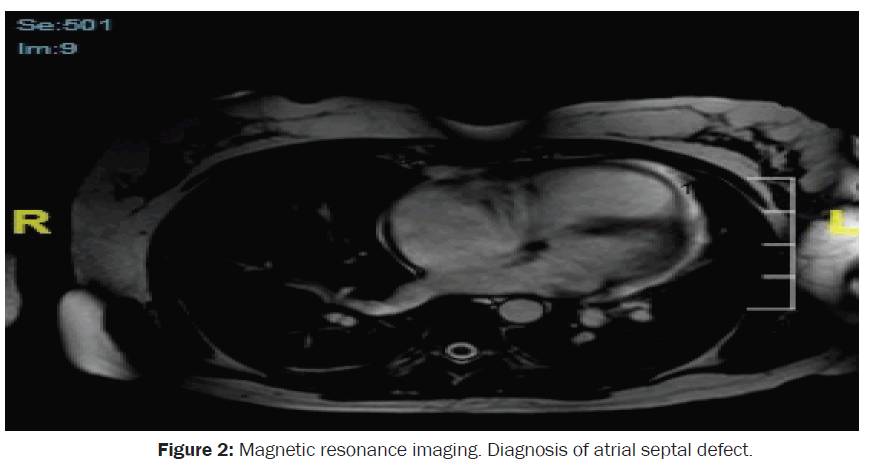 clinical-medical-septal-defect