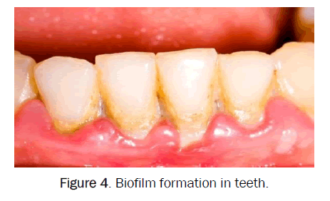 dental-sciences-Biofilm-formation