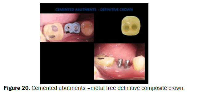dental-sciences-Cemented