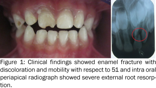 dental-sciences-Clinical-findings-enamel