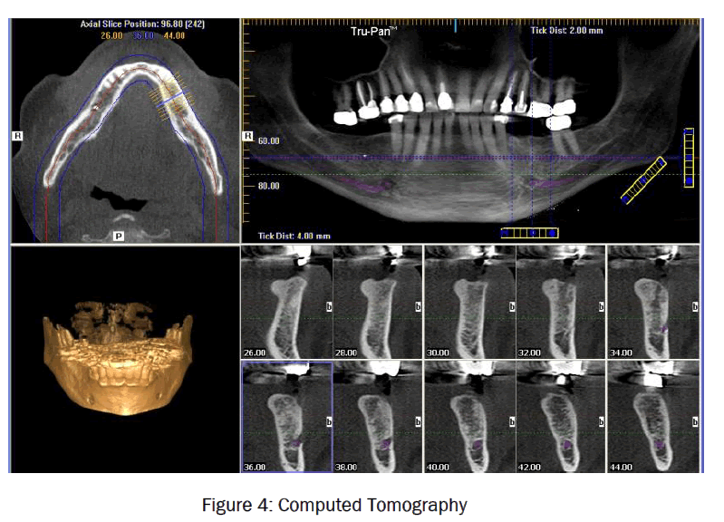 dental-sciences-Computed