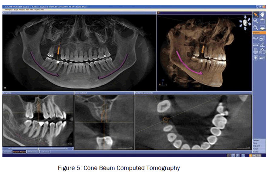 dental-sciences-Cone